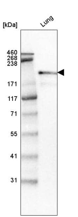 Laminin S/Laminin beta 2 Antibody (CL2979) - Azide and BSA Free, Novus