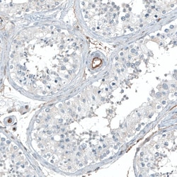 Integrin alpha 5/CD49e Antibody (CL6940) - Azide and BSA Free, Novus Biologicals
