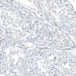Integrin alpha 5/CD49e Antibody (CL6945) - Azide and BSA Free, Novus Biologicals
