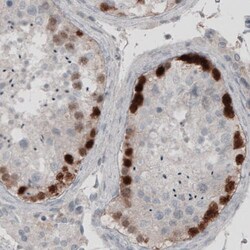 SSX2 Antibody (CL3202) - Azide and BSA Free, Novus Biologicals 100 ul;