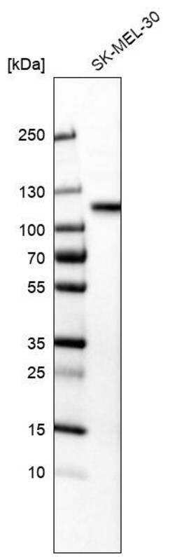 Sortilin Antibody (CL6528) - Azide and BSA Free, Novus Biologicals 100