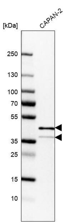 EpCAM/TROP1 Antibody (CL6313) - Azide and BSA Free, Novus Biologicals 100