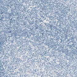 EpCAM/TROP1 Antibody (CL6313) - Azide and BSA Free, Novus Biologicals 100