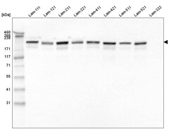 Laminin gamma 1 Antibody (CL3201) - Azide and BSA Free, Novus Biologicals