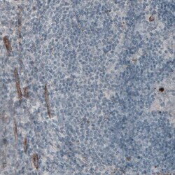 Laminin gamma 1 Antibody (CL3201) - Azide and BSA Free, Novus Biologicals