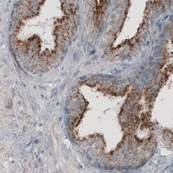ACAA1 Antibody (CL2650) - Azide and BSA Free, Novus Biologicals 100 ul;