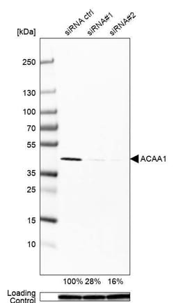 ACAA1 Antibody (CL2650) - Azide and BSA Free, Novus Biologicals 100 ul;