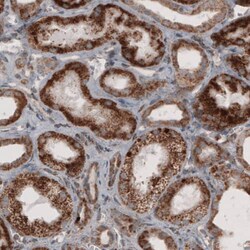 ACAA1 Antibody (CL2660) - Azide and BSA Free, Novus Biologicals 100 ul;