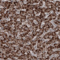 ACAA1 Antibody (CL2660) - Azide and BSA Free, Novus Biologicals 100 ul;