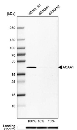 ACAA1 Antibody (CL2660) - Azide and BSA Free, Novus Biologicals 100 ul;
