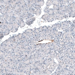 Integrin beta 3/CD61 Antibody (CL7319) - Azide and BSA Free, Novus Biologicals