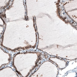 Integrin beta 3/CD61 Antibody (CL7319) - Azide and BSA Free, Novus Biologicals