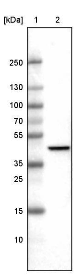 CS Citrate Synthase Antibody (CL2545) - Azide and BSA Free, Novus Biologicals
