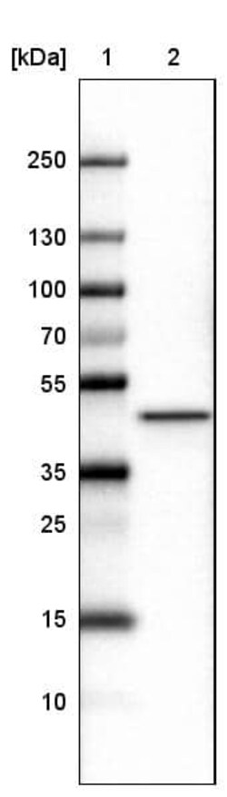 CS Citrate Synthase Antibody (CL2548) - Azide and BSA Free, Novus Biologicals