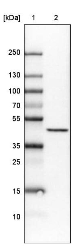 CS Citrate Synthase Antibody (CL2553) - Azide and BSA Free, Novus Biologicals