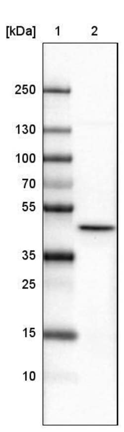 CS Citrate Synthase Antibody (CL2579) - Azide and BSA Free, Novus Biologicals 100 &mu;L | Buy Online | Novus Biologicals | Fisher Scientific