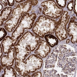 CS Citrate Synthase Antibody (CL2579) - Azide and BSA Free, Novus Biologicals 100 &mu;L | Buy Online | Novus Biologicals | Fisher Scientific