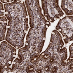CS Citrate Synthase Antibody (CL2579) - Azide and BSA Free, Novus Biologicals 100 &mu;L | Buy Online | Novus Biologicals | Fisher Scientific