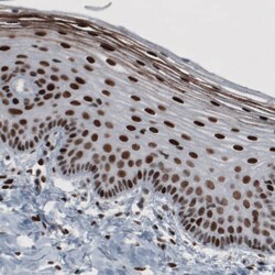 hnRNP C1 + C2 Antibody (CL2596) - Azide and BSA Free, Novus Biologicals