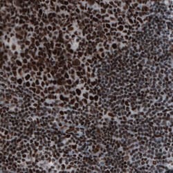 hnRNP C1 + C2 Antibody (CL2596) - Azide and BSA Free, Novus Biologicals