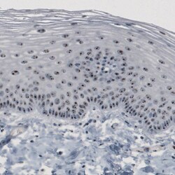 NOP56 Antibody (CL2603) - Azide and BSA Free, Novus Biologicals 100 ul;