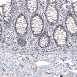 NIFK Antibody (CL2240) - Azide and BSA Free, Novus Biologicals 100 ul;