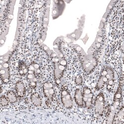 NIFK Antibody (CL2237) - Azide and BSA Free, Novus Biologicals 100 &mu;L | Buy Online | Novus Biologicals | Fisher Scientific