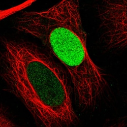 PARP Antibody (CL2220) - Azide and BSA Free, Novus Biologicals 100 ul;