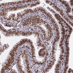 PARP Antibody (CL2220) - Azide and BSA Free, Novus Biologicals 100 ul;