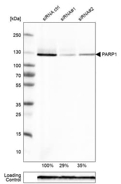 PARP Antibody (CL2220) - Azide and BSA Free, Novus Biologicals 100 ul;