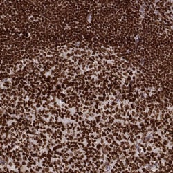 PARP Antibody (CL2220) - Azide and BSA Free, Novus Biologicals 100 ul;