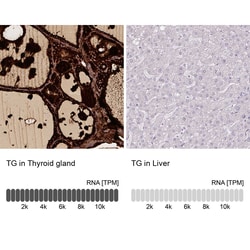 Thyroglobulin Antibody (CL0164) - Azide and BSA Free, Novus Biologicals
