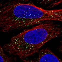PMP70 Antibody (CL2524) - Azide and BSA Free, Novus Biologicals 100 ul;
