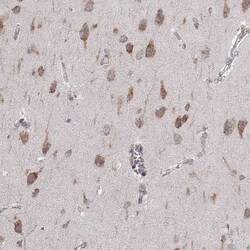 ERp57/PDIA3 Antibody (CL2444) - Azide and BSA Free, Novus Biologicals 100