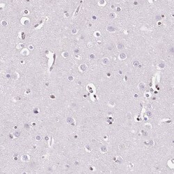 NRSF Antibody (CL0381) - Azide and BSA Free, Novus Biologicals 100 ul;