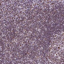 NRSF Antibody (CL0381) - Azide and BSA Free, Novus Biologicals 100 ul;
