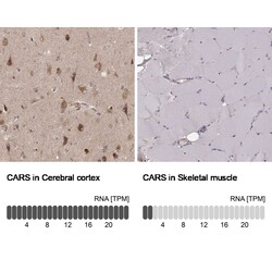 CARS Antibody (CL2302) - Azide and BSA Free, Novus Biologicals 100 ul;