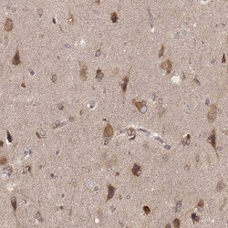 CARS Antibody (CL2302) - Azide and BSA Free, Novus Biologicals 100 ul;