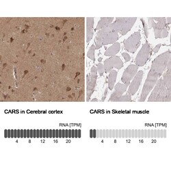 CARS Antibody (CL2309) - Azide and BSA Free, Novus Biologicals 100 ul;