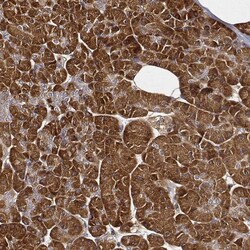 CARS Antibody (CL2310) - Azide and BSA Free, Novus Biologicals 100 ul;