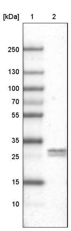 Ly6K Antibody (CL2433) - Azide and BSA Free, Novus Biologicals 100 ul;