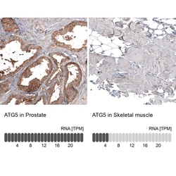 ATG5 Antibody (CL9508) - Azide and BSA Free, Novus Biologicals 100 ul;
