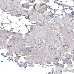 ATG5 Antibody (CL9508) - Azide and BSA Free, Novus Biologicals 100 ul;