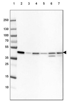 beta-Actin Antibody (CL3868) - Azide and BSA Free, Novus Biologicals 100 &mu;L | Buy Online | Novus Biologicals | Fisher Scientific