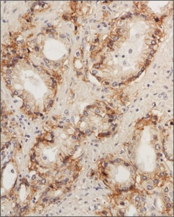 STEAP1 Antibody, Novus Biologicals 0.025 mg | Buy Online | Novus Biologicals | Fisher Scientific