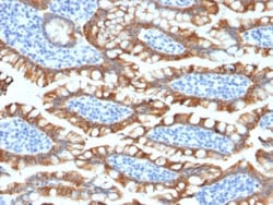 Cytokeratin 8 Antibody (KRT8/2174R) - Azide and BSA Free, Novus Biologicals&trade;