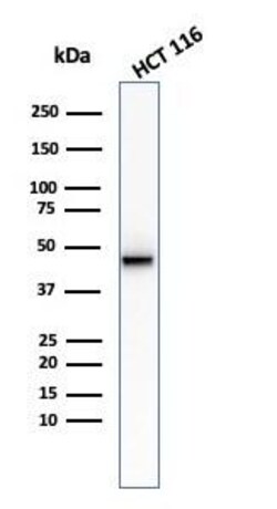 Cytokeratin 8 Antibody (KRT8/2174R) - Azide and BSA Free, Novus Biologicals 100 &mu;g | Buy Online | R&D Systems | Fisher Scientific