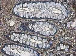 non-muscle Myosin IIA, p Ser1943 Antibody (GT144), Novus Biologicals 100 &mu;g | Buy Online | Novus Biologicals | Fisher Scientific