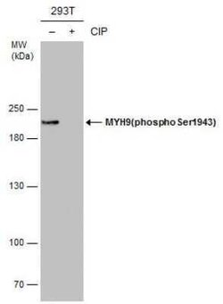 non-muscle Myosin IIA, p Ser1943 Antibody (GT144), Novus Biologicals 100 &mu;g | Buy Online | Novus Biologicals | Fisher Scientific