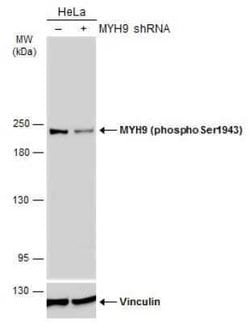 non-muscle Myosin IIA, p Ser1943 Antibody (GT144), Novus Biologicals 100 &mu;g | Buy Online | Novus Biologicals | Fisher Scientific